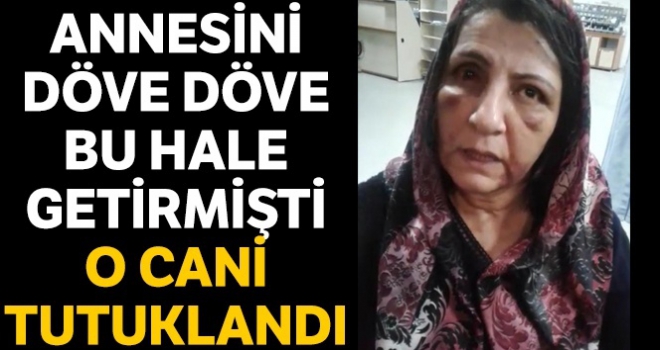 Annesini döverek hastanelik eden şahıs tutuklandı