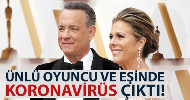 ABD'li ünlü aktör Tom Hanks ve eşi virüse yakalandı