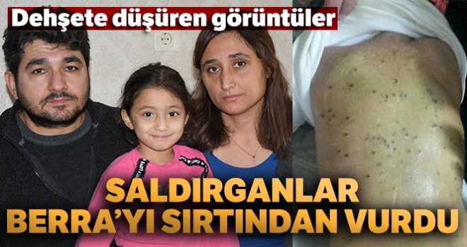 Silahlı saldırganlar küçük Berra'yı sırtından vurdu