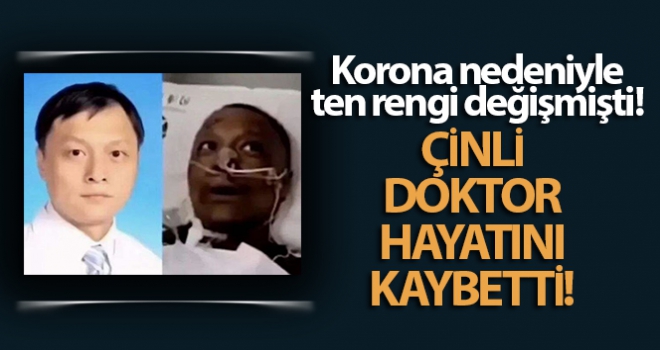 Korona nedeniyle ten rengi değişen Çinli doktor hayatını kaybetti